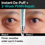 CISL Seoul PDRN Cooling Metal Roller Eye Cream – 15ml for Dark Circles & Puffiness — view 3 of 7