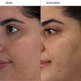 Skin Pharm Crystal Clear Clarifying Pads 60-count container with 2% salicylic acid for acne-prone skin - view 4