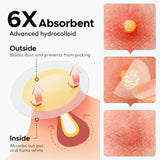 LitBear hydrocolloid pimple patches 165-count pack with salicylic acid and tea tree oil for acne spot treatment - view 6