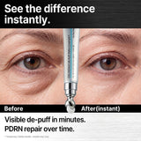 CISL Seoul PDRN Cooling Metal Roller Eye Cream – 15ml for Dark Circles & Puffiness — view 2 of 7